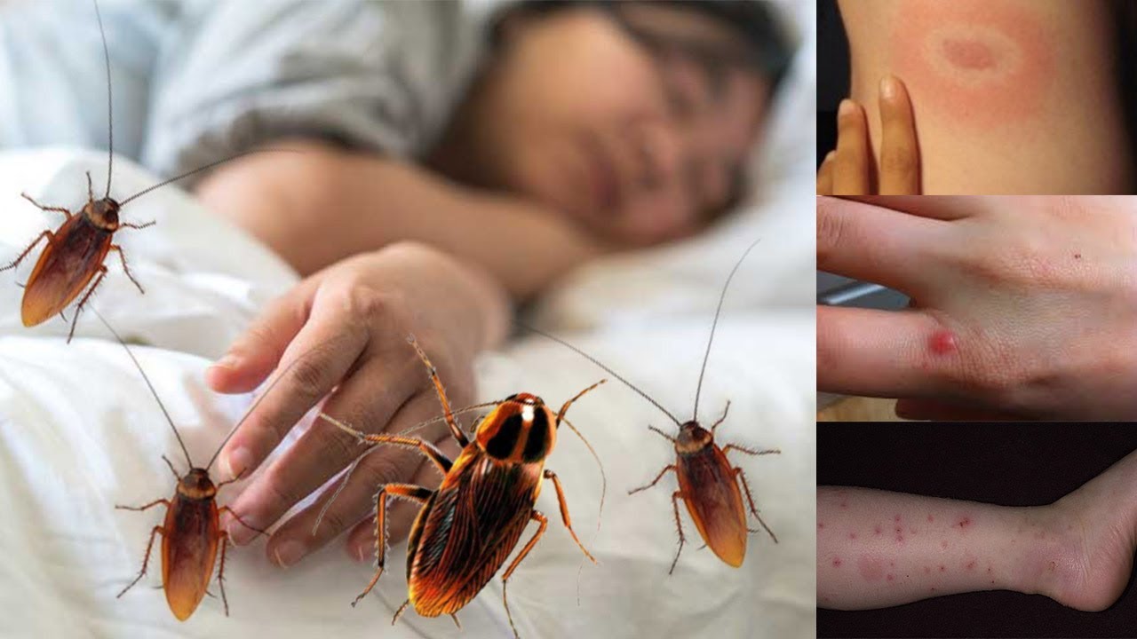 Кусают ли домашние тараканы человека