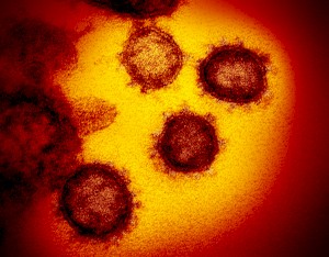 Фото коронавируса 2019-nCoV при помощи  просвечивающего электронного микроскопа.