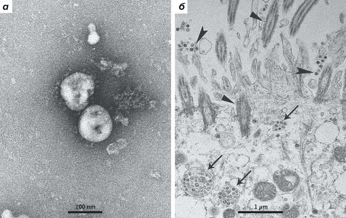Визуализация 2019-nCoV с помощью трансмиссионной электронной микроскопии: изолированные частицы вируса (слева) и вирус в клетках дыхательных путей человека (справа; отмечен стрелками)