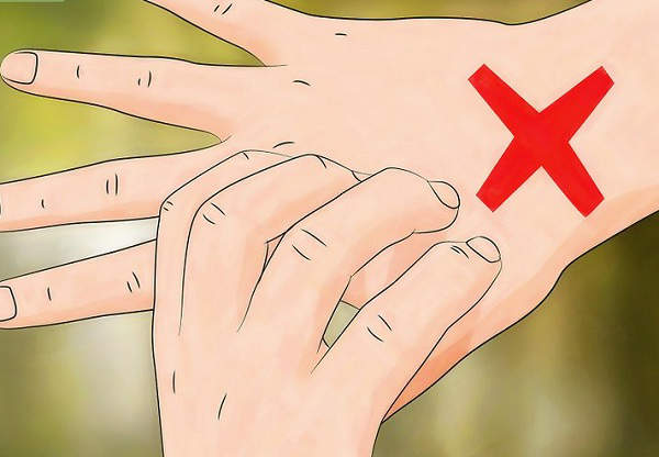 cockroach-sting-what-to-do.jpg
