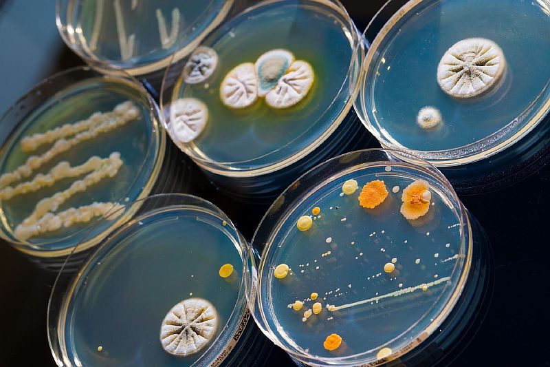 chashki-petri-s-koloniyami-bakteriy.jpg