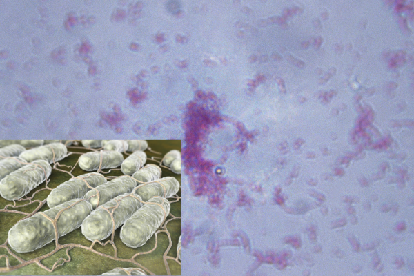 Salmonella typhi (Salmonella enterica серотип typhi)